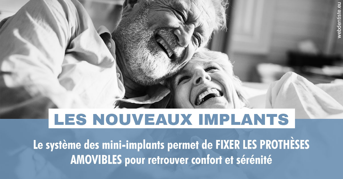 https://www.drrichardgrosman.fr/Les nouveaux implants 2