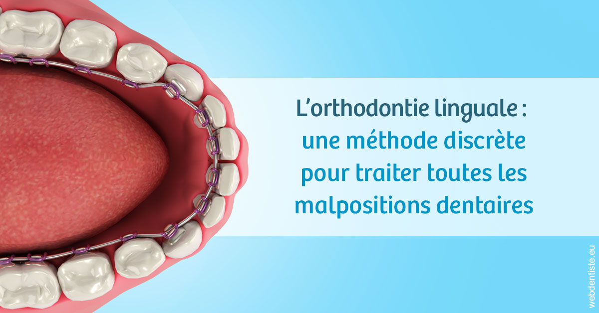 https://www.drrichardgrosman.fr/L'orthodontie linguale 1