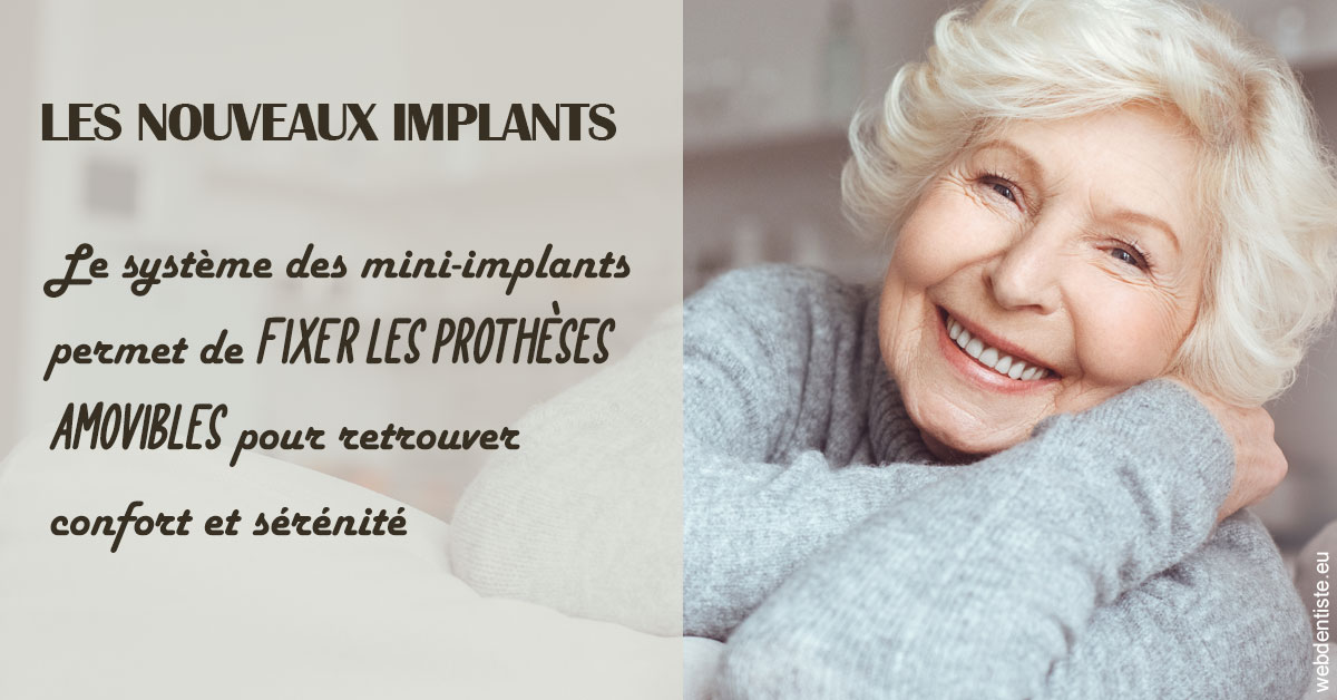 https://www.drrichardgrosman.fr/Les nouveaux implants 1