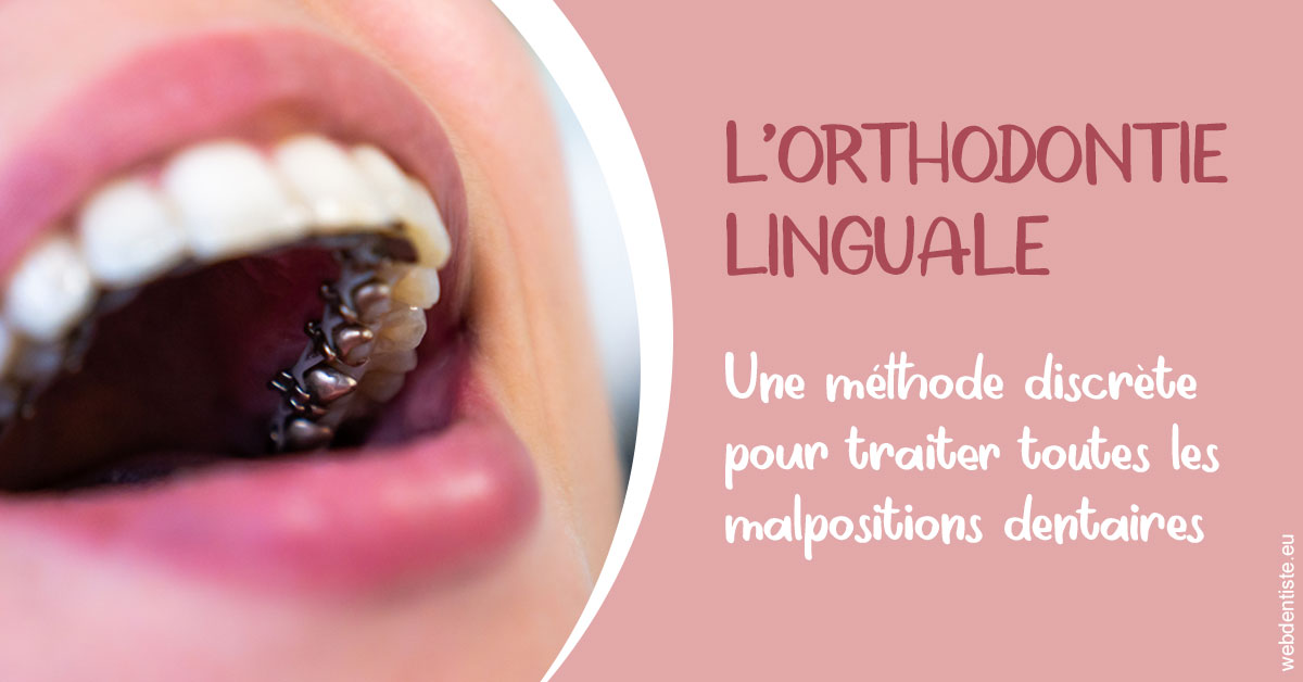https://www.drrichardgrosman.fr/L'orthodontie linguale 2