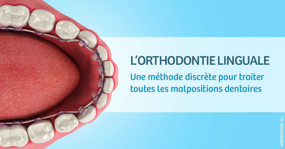 https://www.drrichardgrosman.fr/L'orthodontie linguale 1