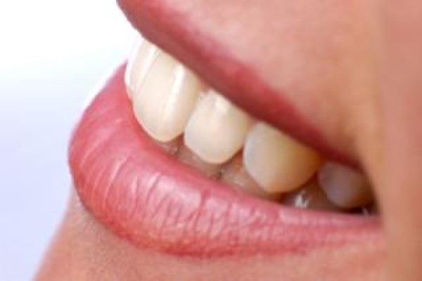 Esthétique dentaire paris - Dr Grosman Richard dentiste à paris 2 - 75002