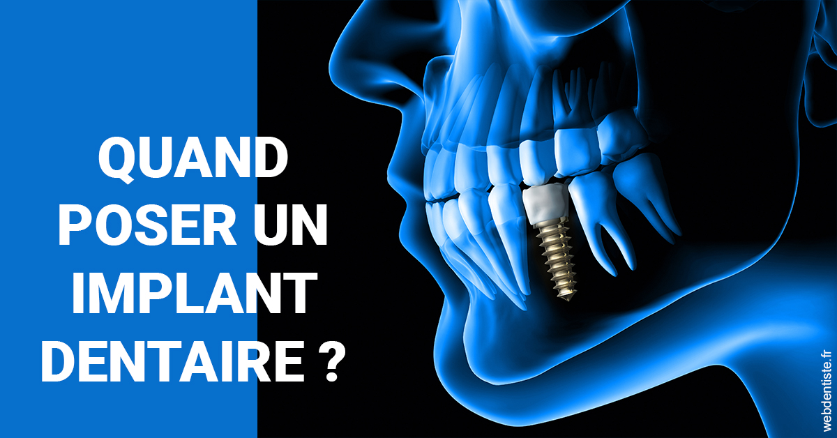 https://www.drrichardgrosman.fr/Les implants 1
