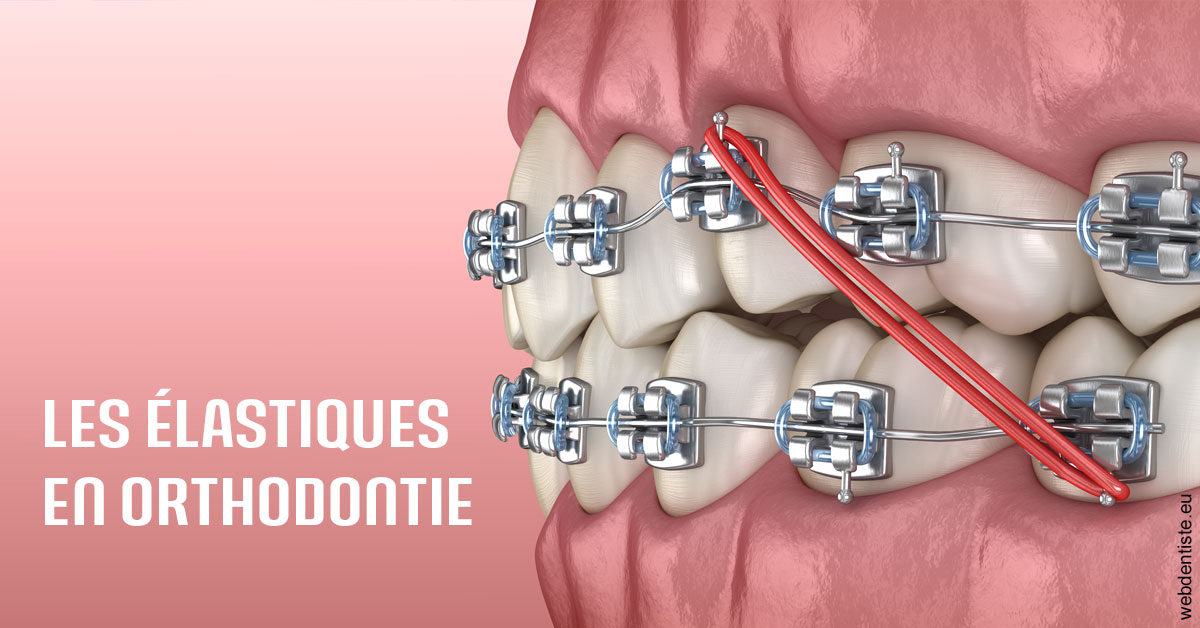 https://www.drrichardgrosman.fr/Elastiques orthodontie 2